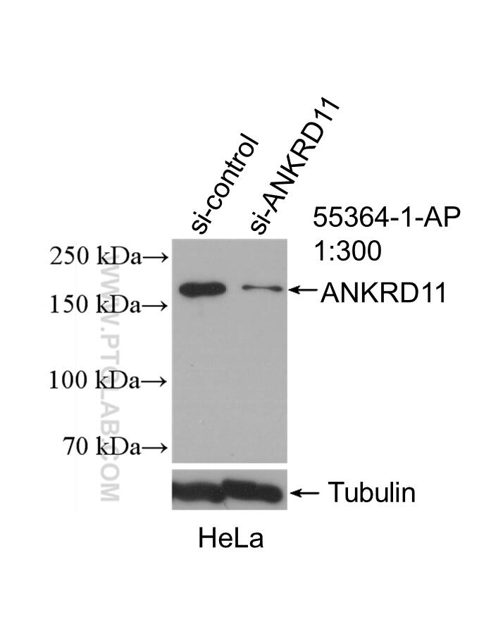 WB analysis of HeLa using 55364-1-AP