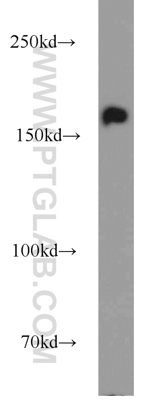 WB analysis of BxPC-3 using 55364-1-AP