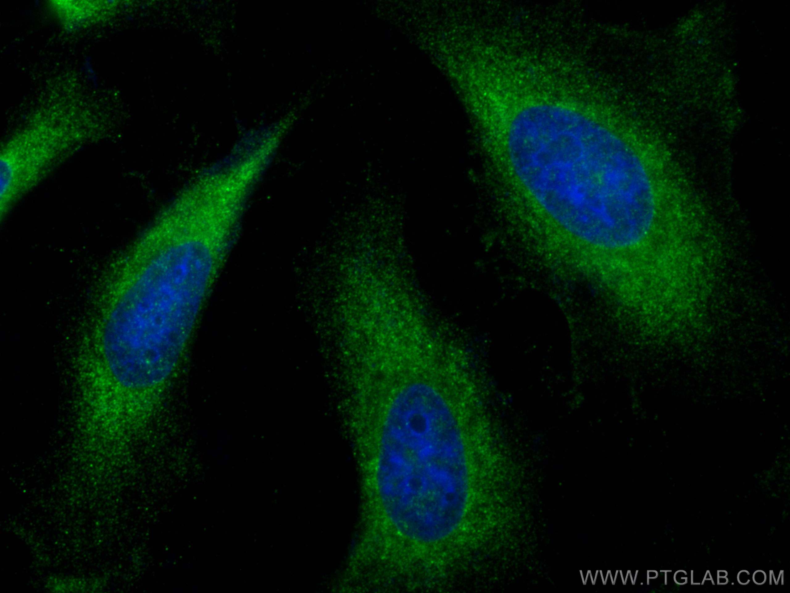 IF Staining of HeLa using 24334-1-AP