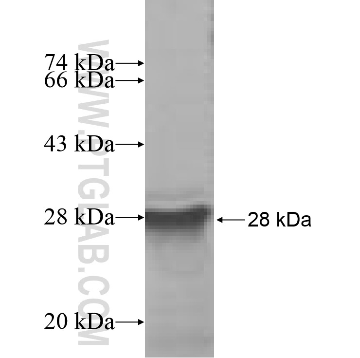 ANKRD16 fusion protein Ag7343 SDS-PAGE