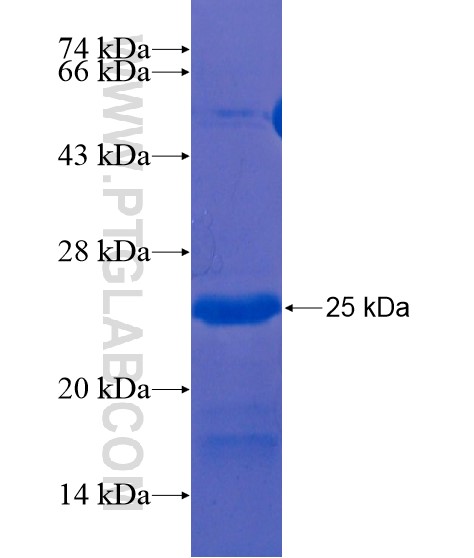 ANKRD22 fusion protein Ag21248 SDS-PAGE