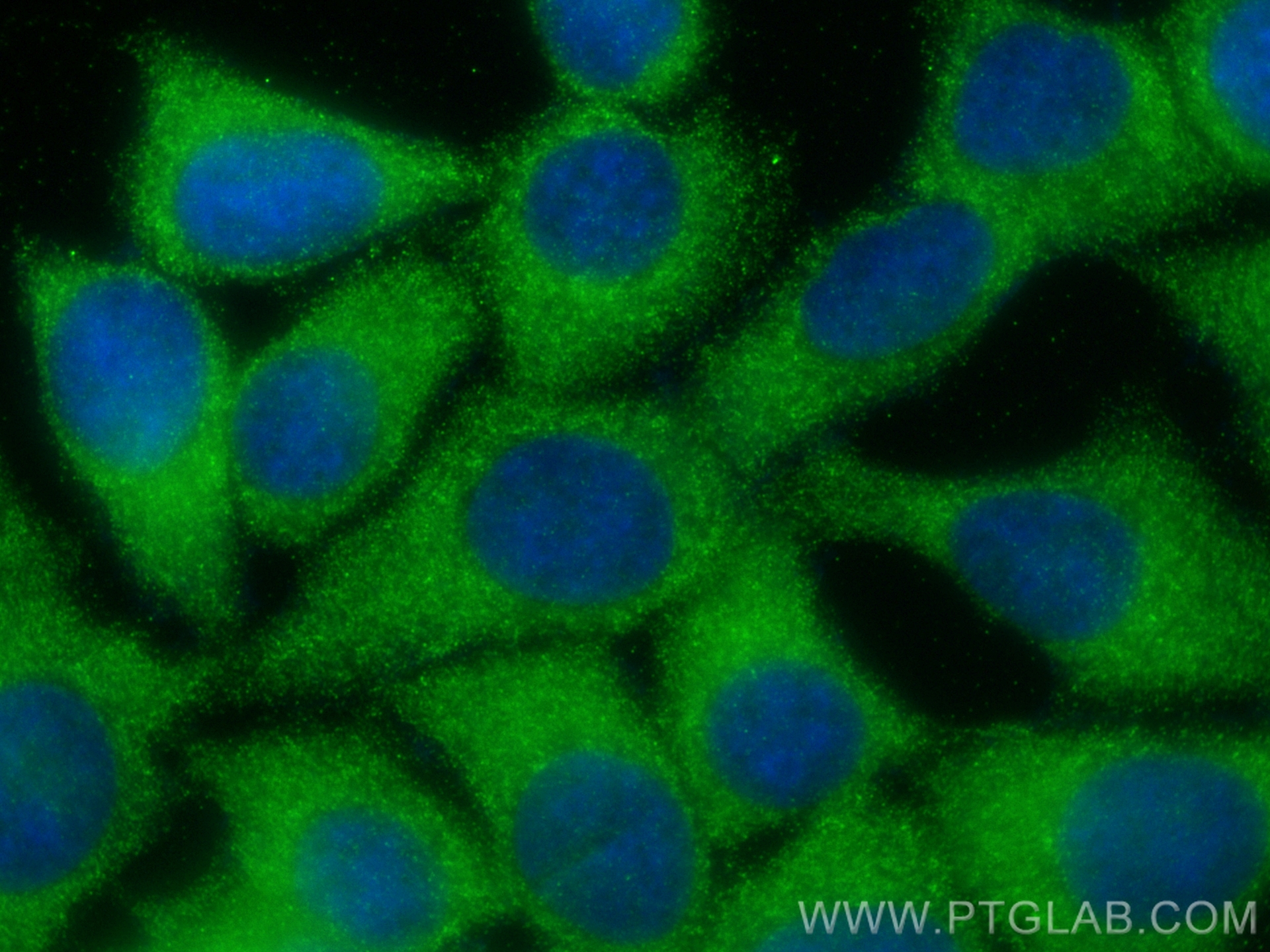 IF Staining of MCF-7 using 24034-1-AP