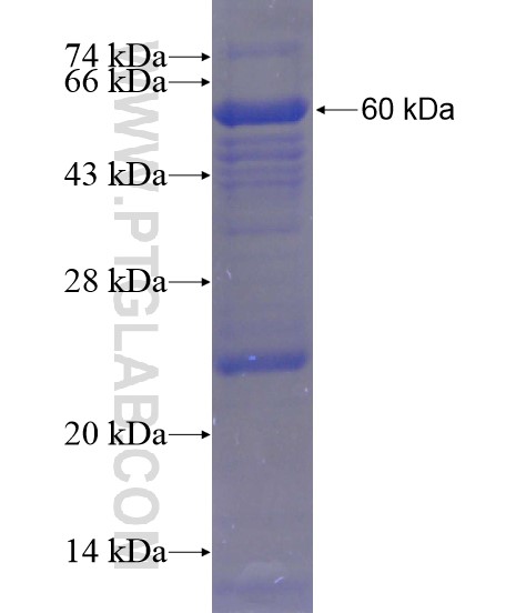 ANKRD27 fusion protein Ag21239 SDS-PAGE