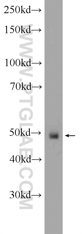 WB analysis of Y79 using 25202-1-AP