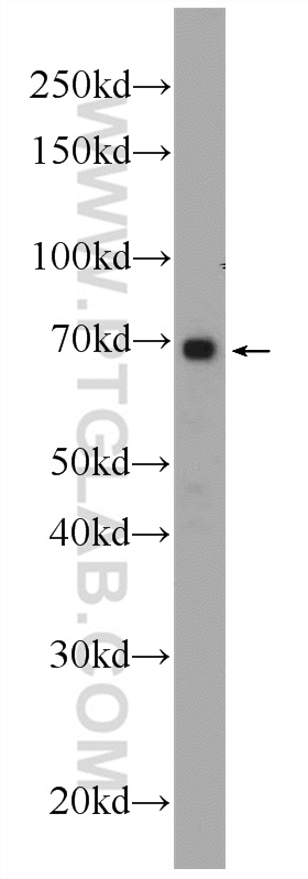 WB analysis of HeLa using 24283-1-AP