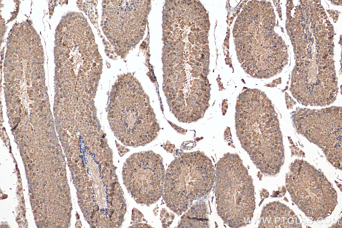 IHC staining of mouse testis using 25738-1-AP