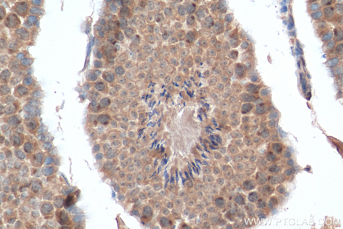 IHC staining of mouse testis using 25738-1-AP