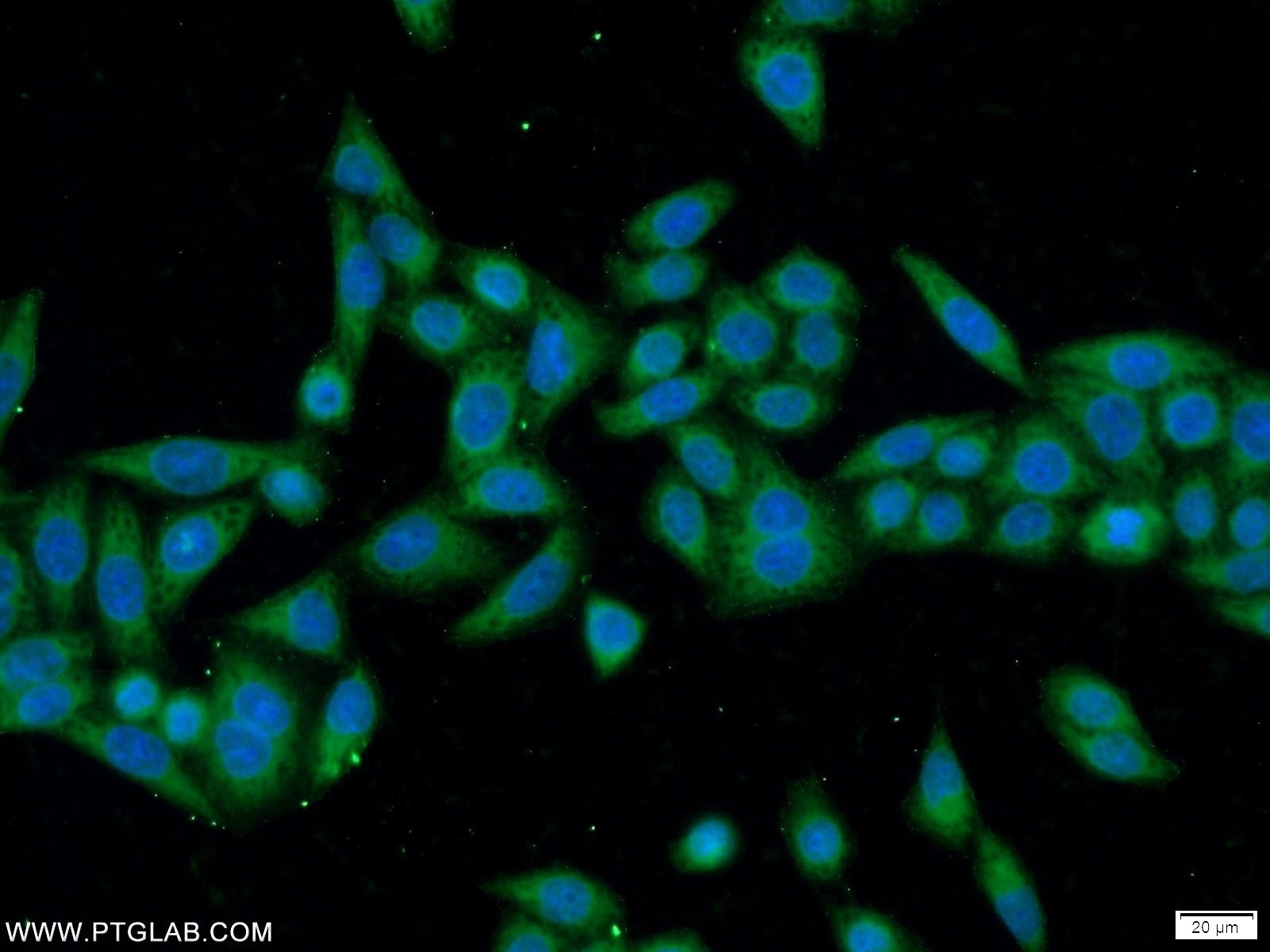 IF Staining of HeLa using 24203-1-AP