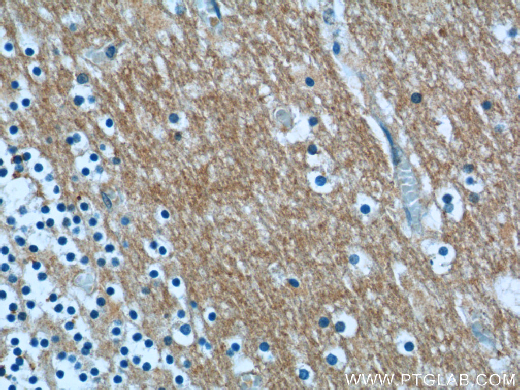 IHC staining of human cerebellum using 24033-1-AP