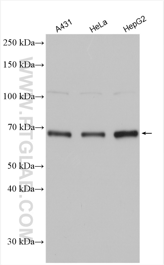 WB analysis using 24033-1-AP