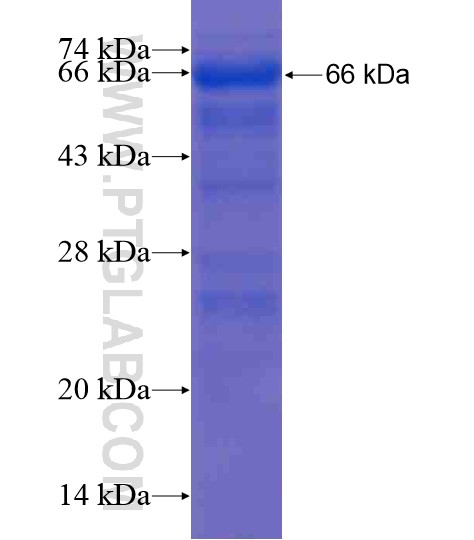 ANKRD57 fusion protein Ag21238 SDS-PAGE