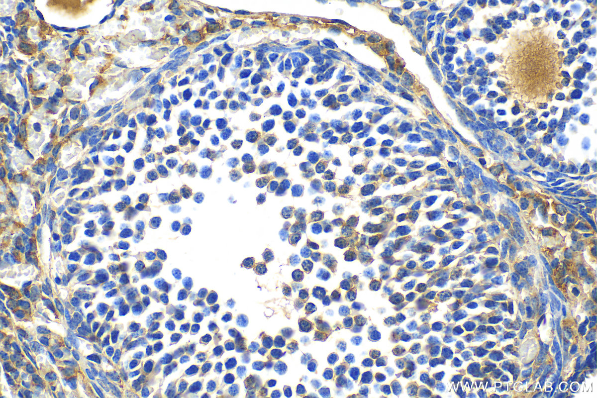 IHC staining of mouse ovary using 24333-1-AP