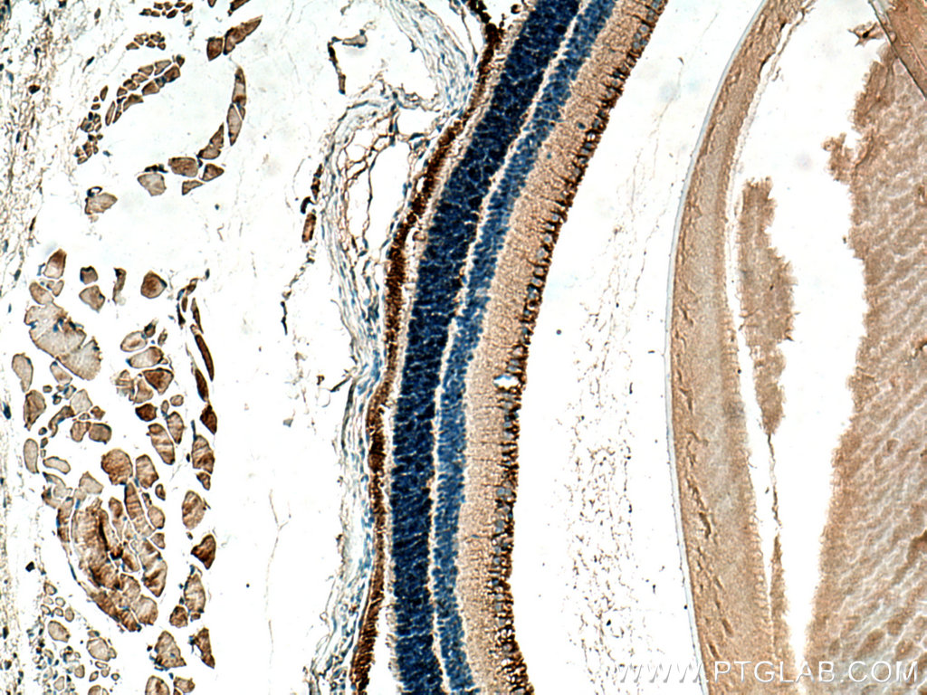 IHC staining of mouse eye using 20647-1-AP