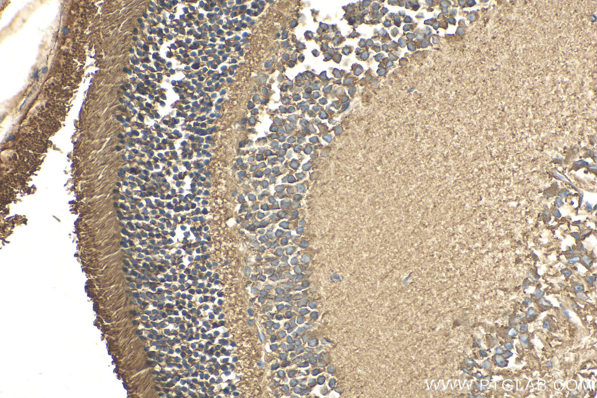 IHC staining of mouse eye using 20647-1-AP