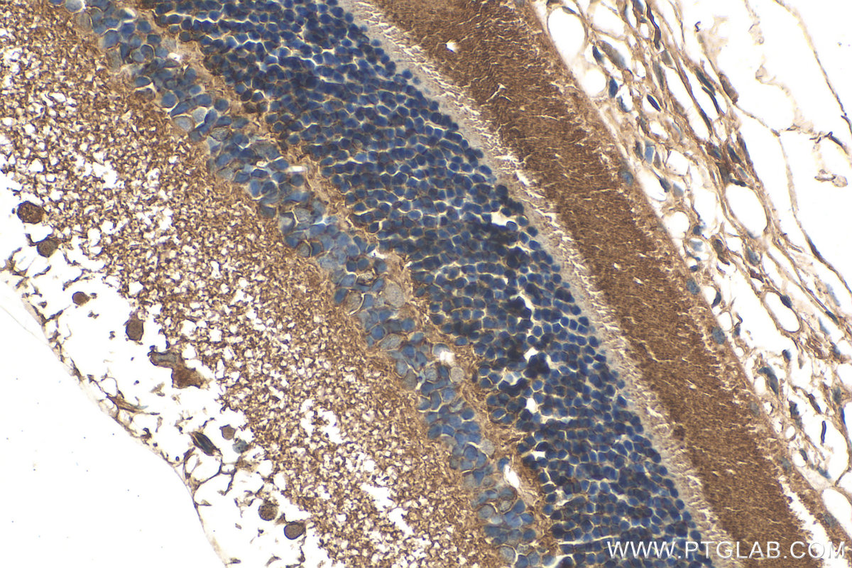 IHC staining of rat eye using 20647-1-AP