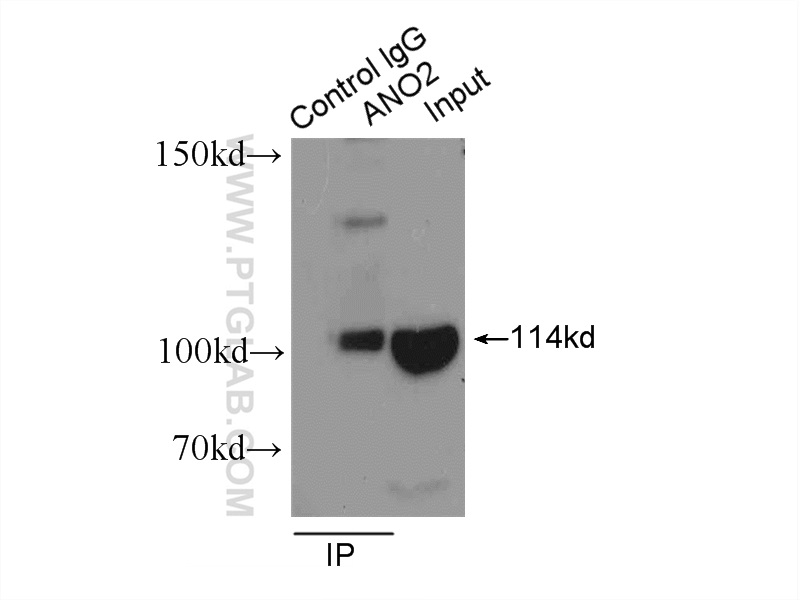 IP experiment of mouse brain using 20647-1-AP