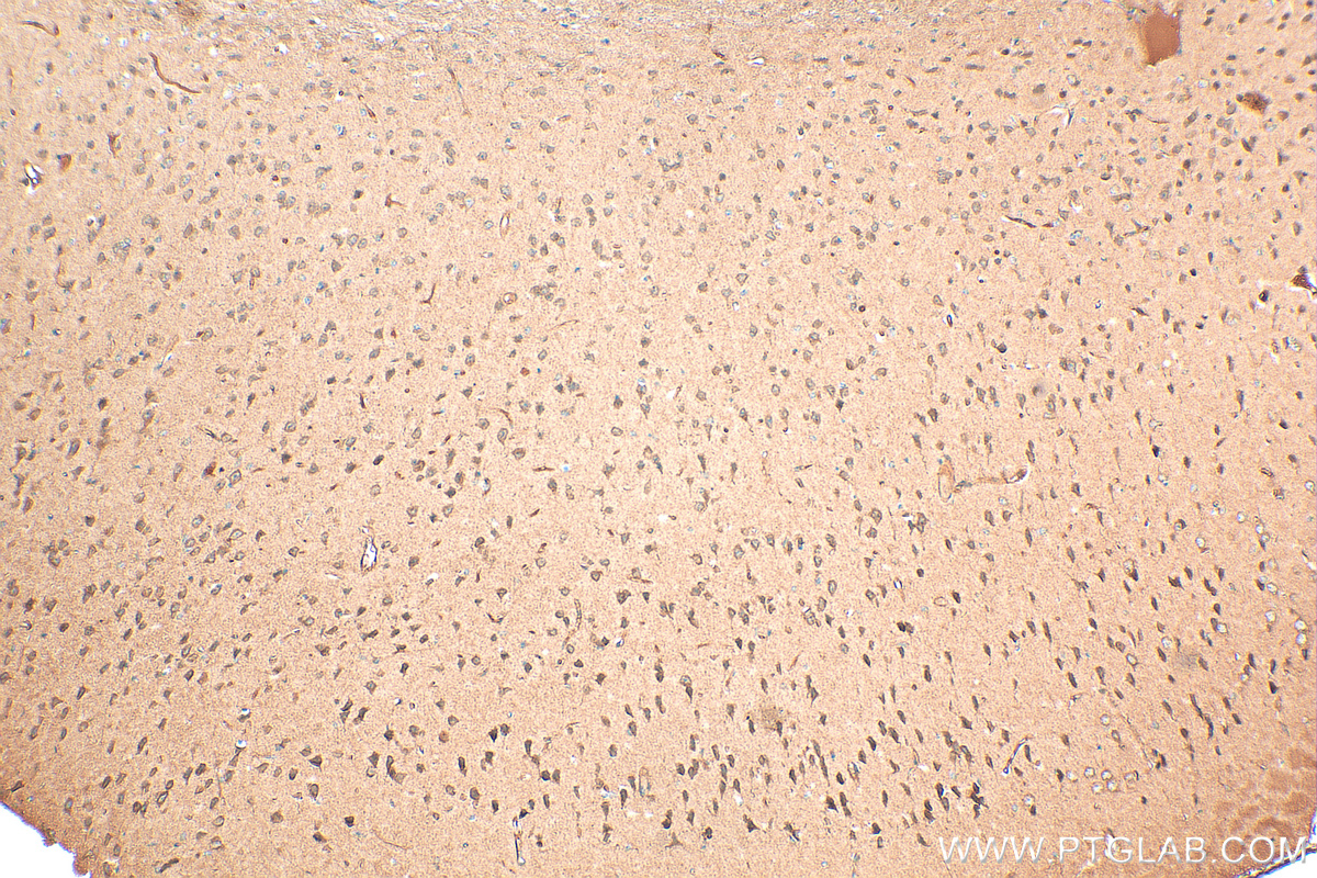 IHC staining of mouse brain using 19485-1-AP