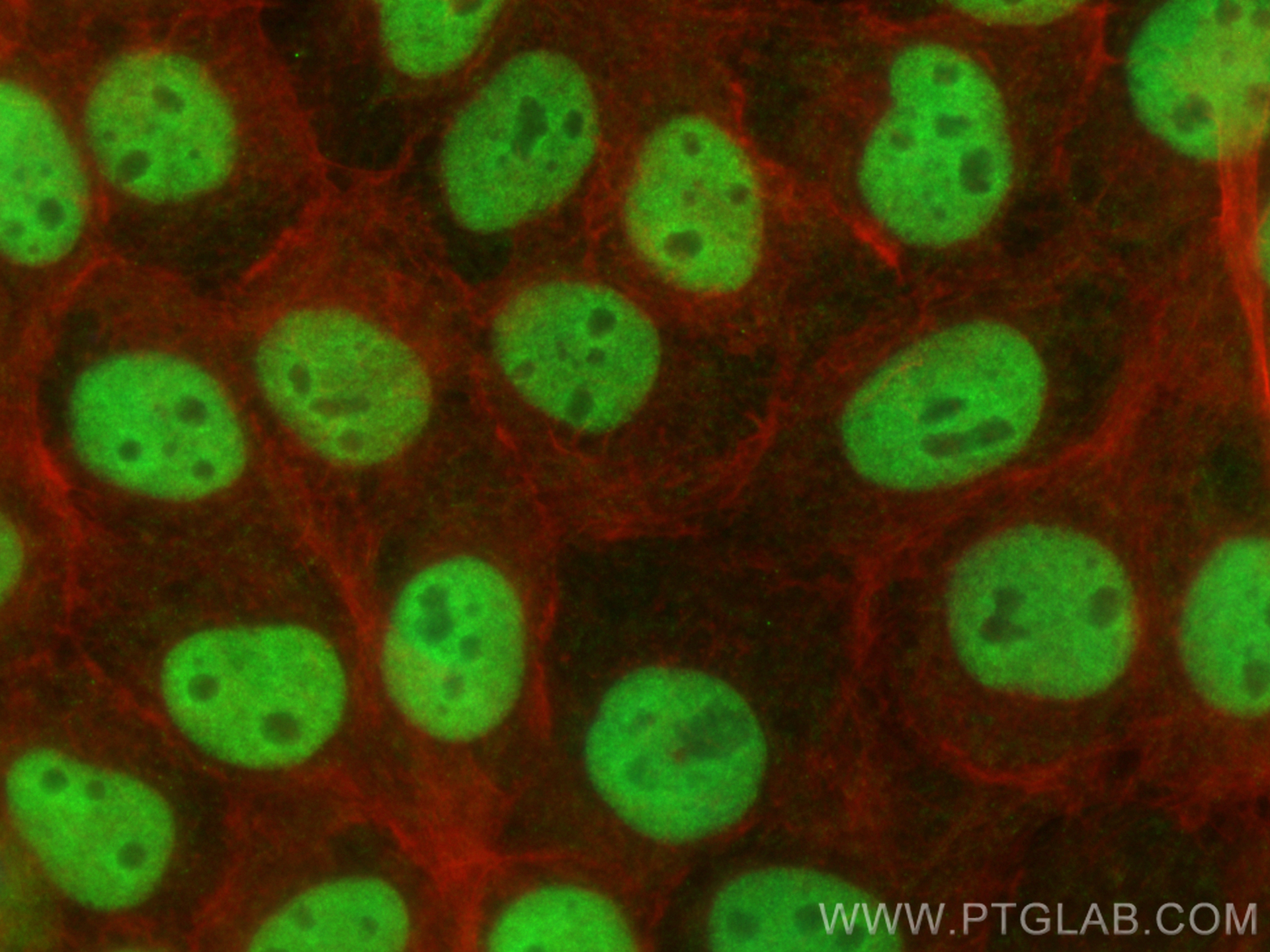 IF Staining of A431 using CL488-67687