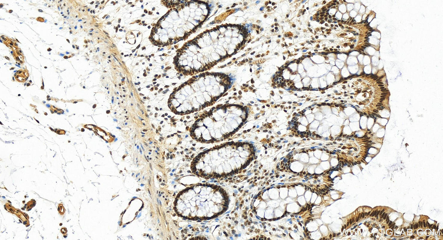 IHC staining of human colon using 10843-1-AP