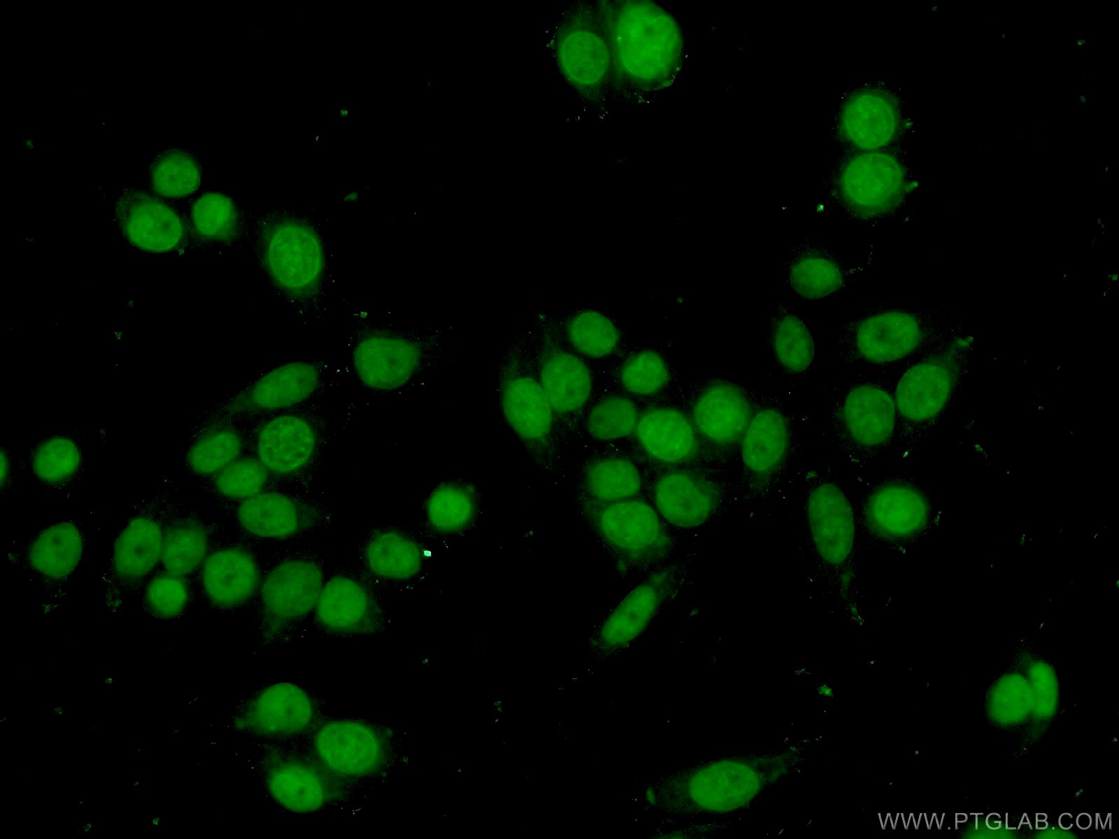 ANP32B Polyclonal antibody