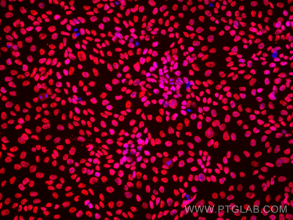 IF Staining of A431 using 66160-1-Ig (same clone as 66160-1-PBS)