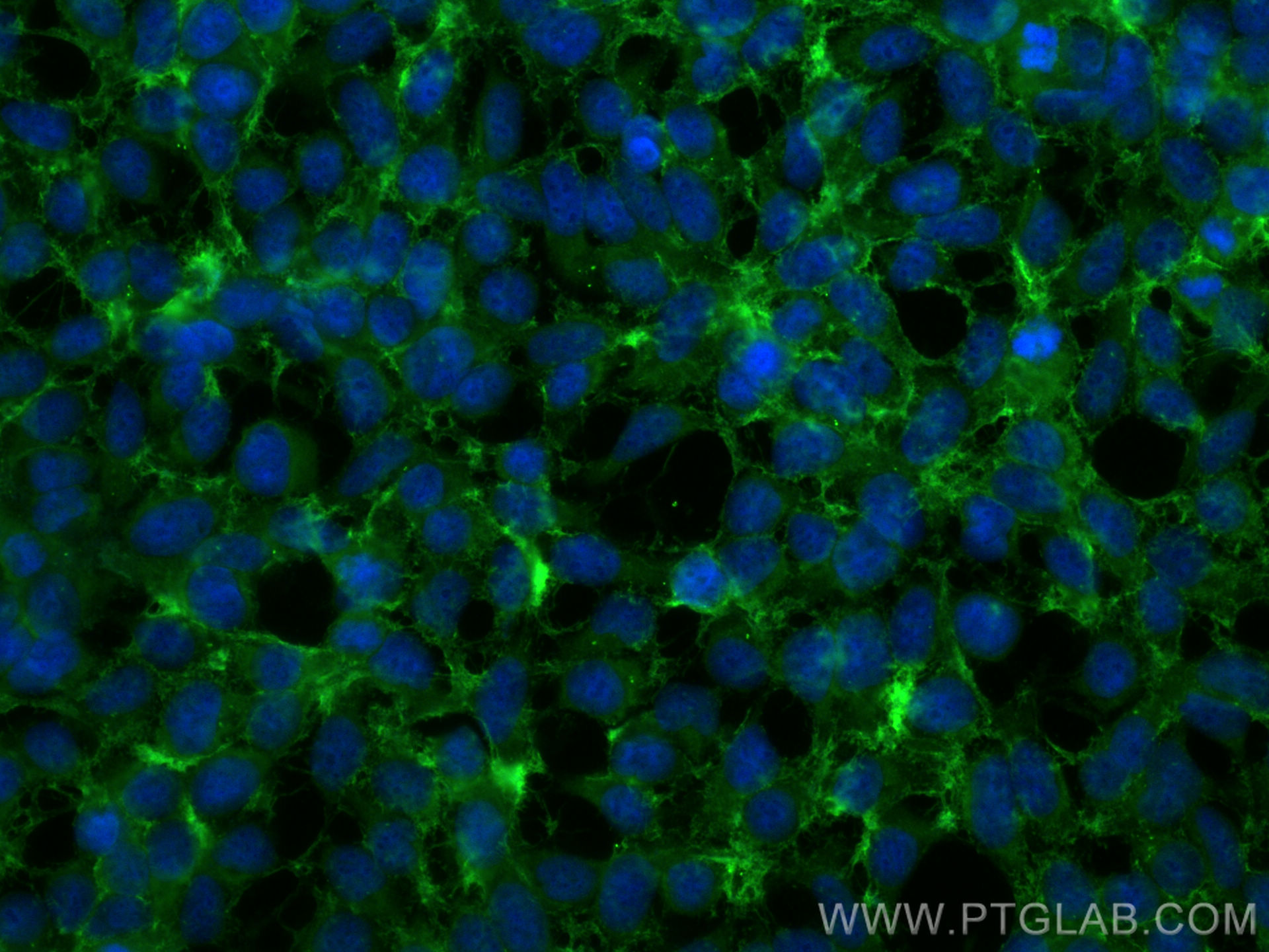 IF Staining of HEK-293 using 14553-1-AP