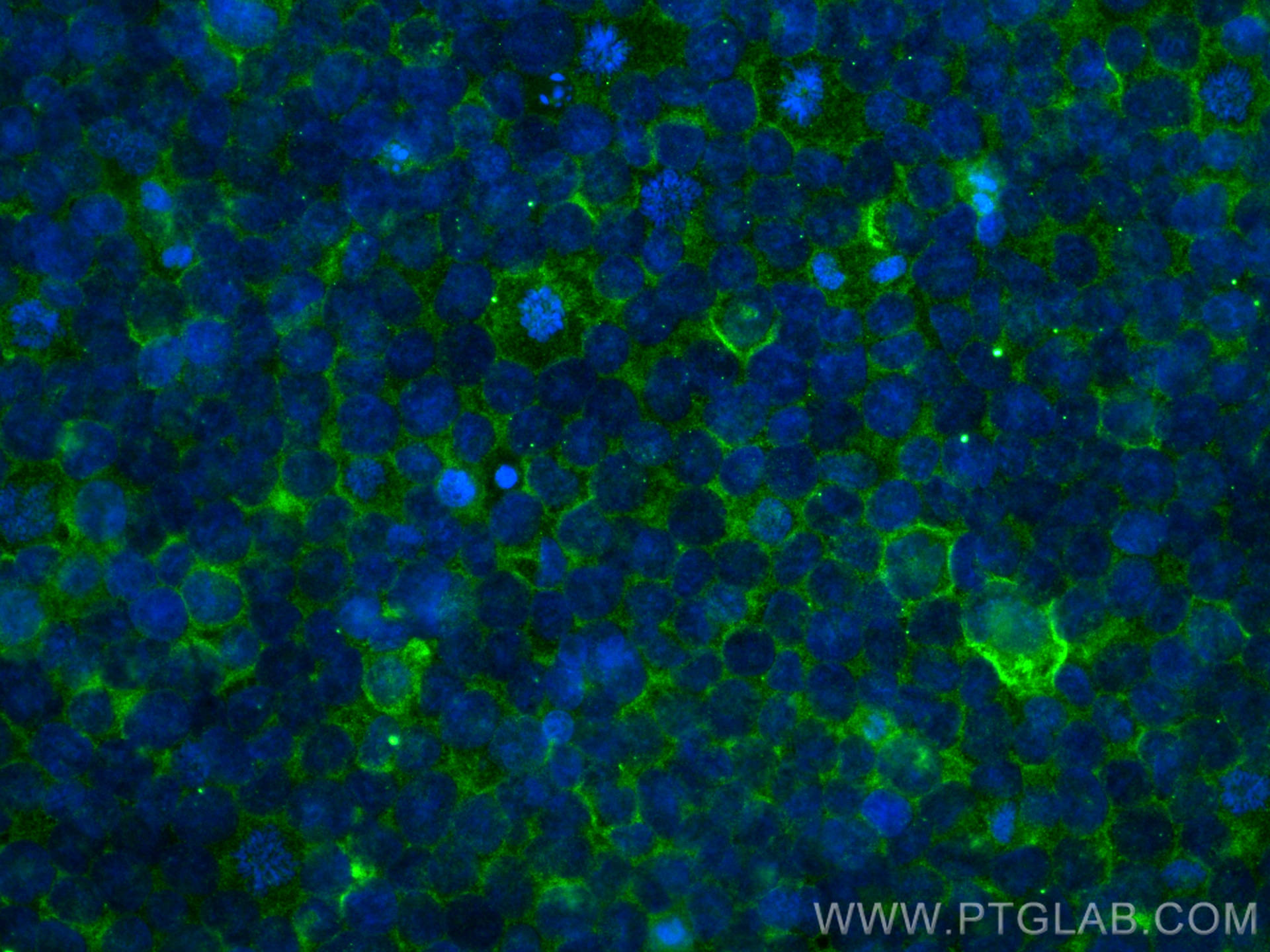 IF Staining of THP-1 using 66211-1-Ig