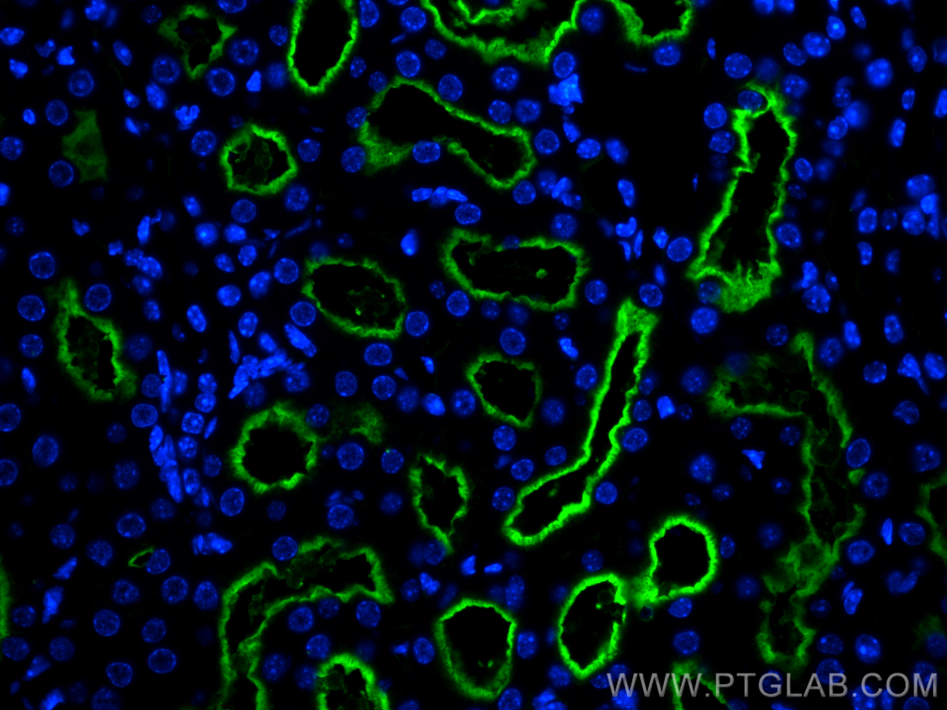 IF Staining of mouse kidney using 66211-1-Ig