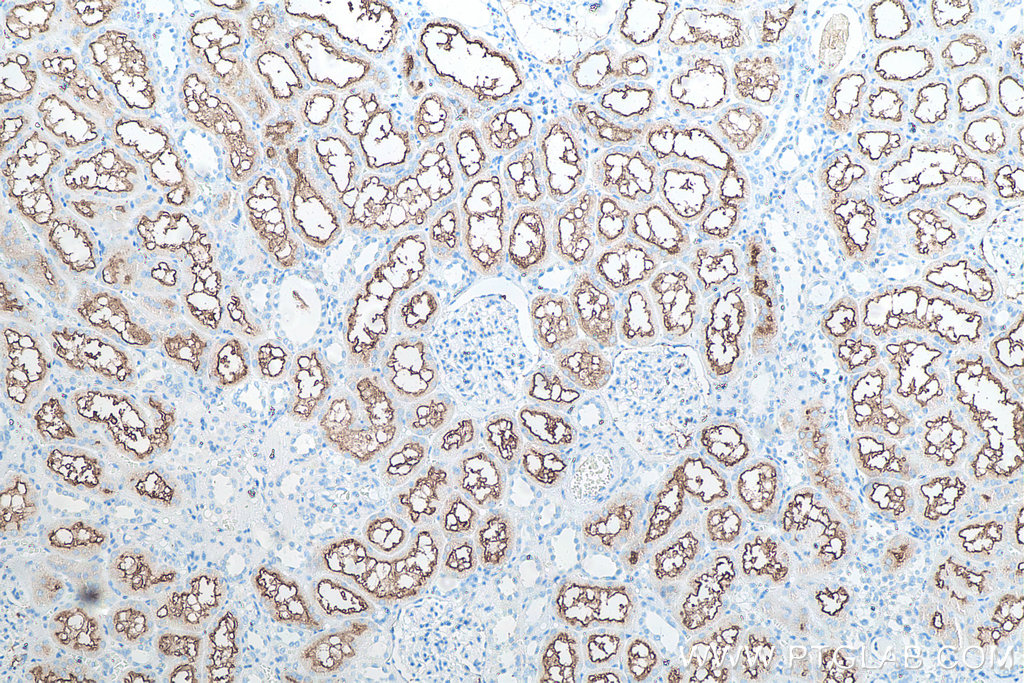 IHC staining of human kidney using 66211-1-Ig