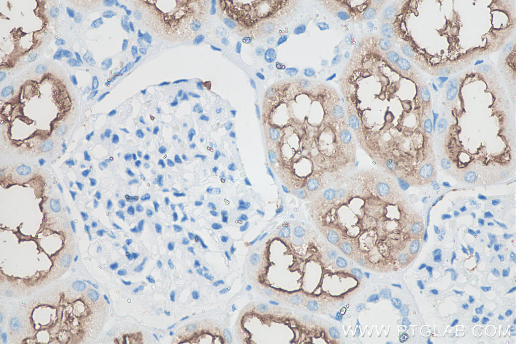 IHC staining of human kidney using 66211-1-Ig