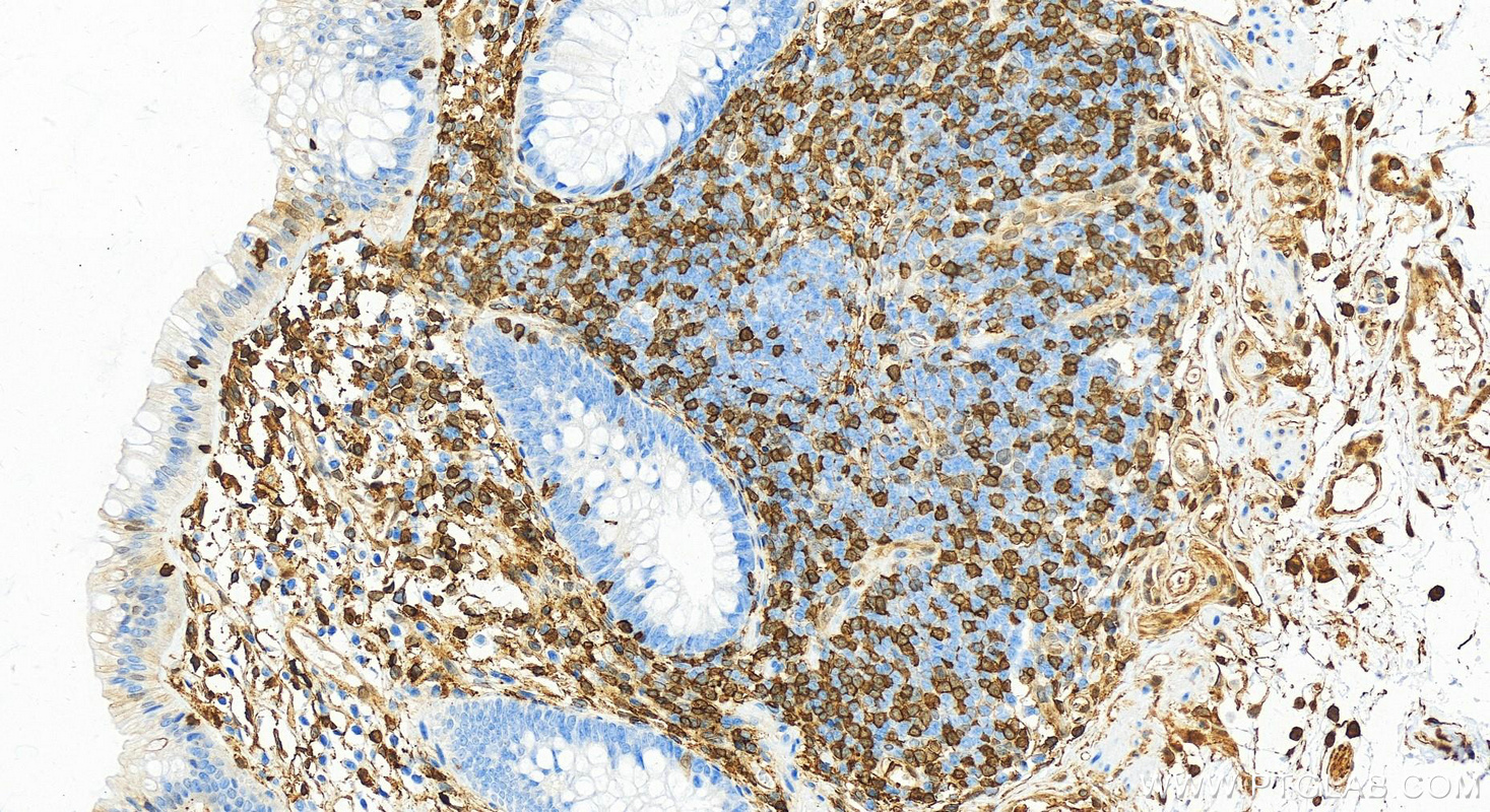 IHC staining of human colon using 21990-1-AP