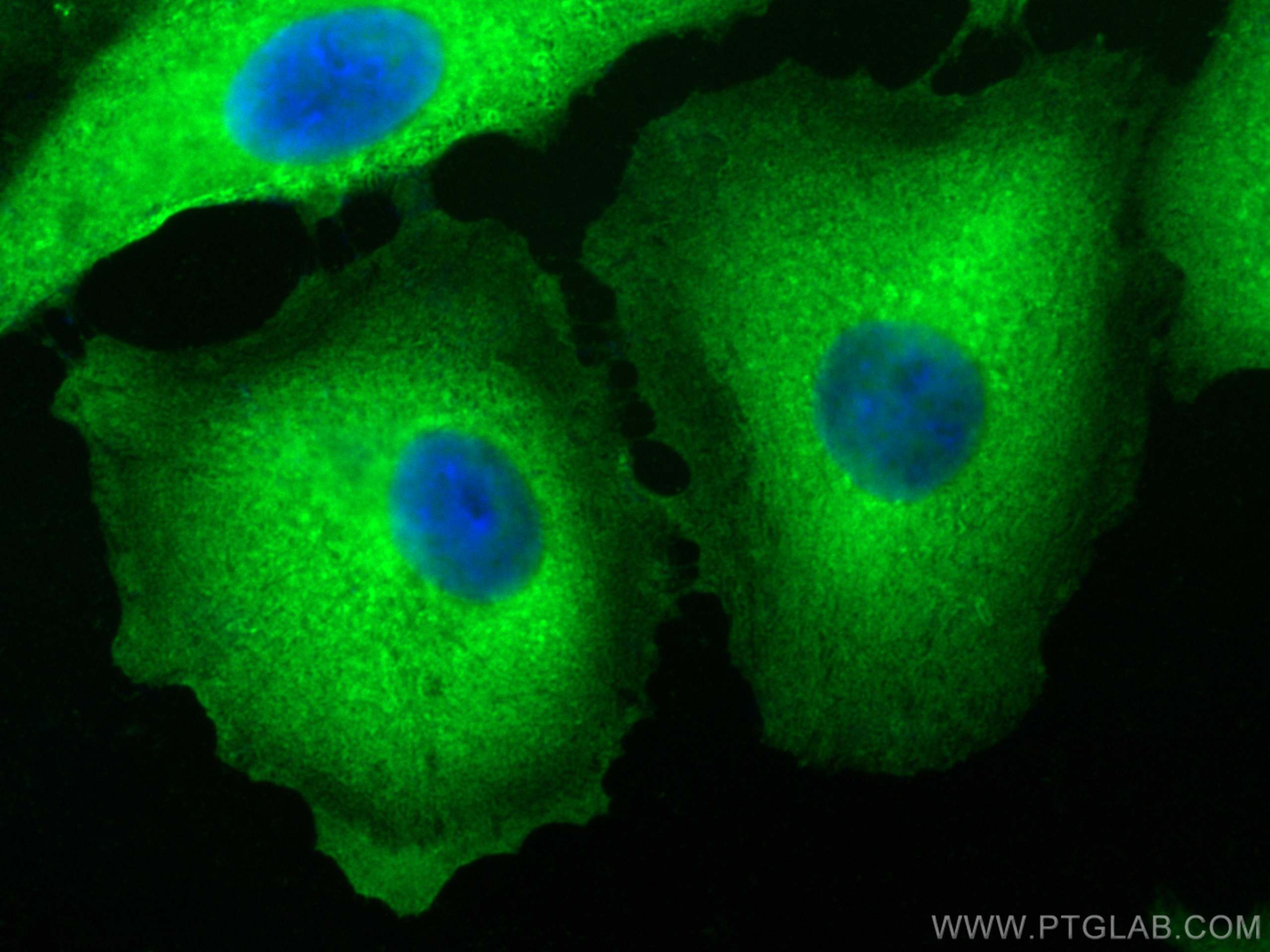 IF Staining of A549 using 21990-1-AP