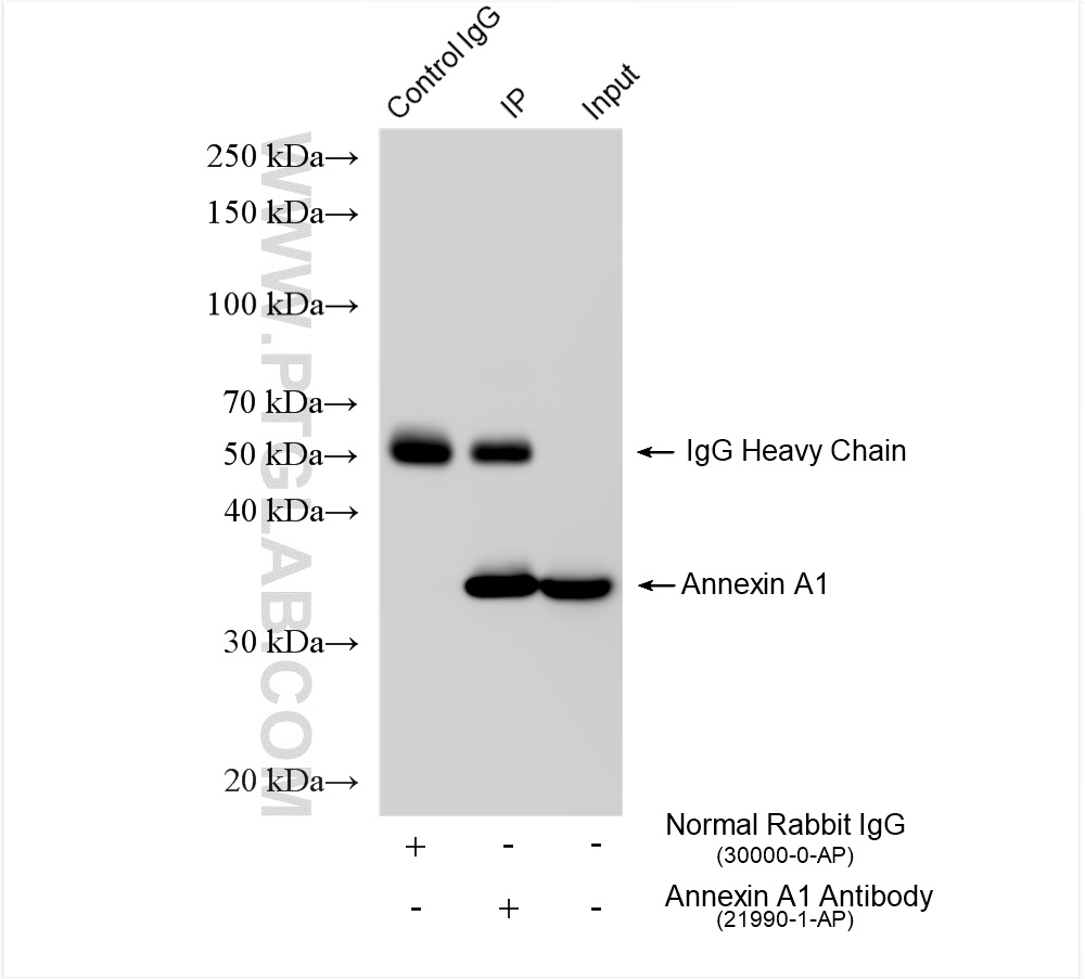 IP experiment of HeLa using 21990-1-AP