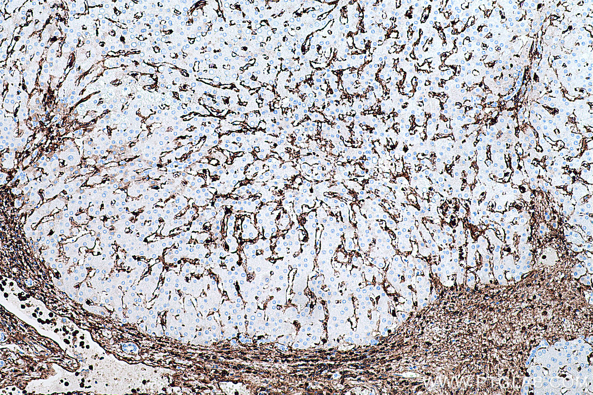 IHC staining of human liver using 66344-1-Ig