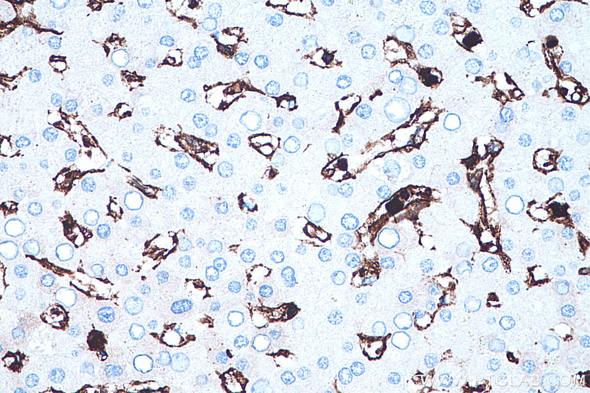 IHC staining of human liver using 66344-1-Ig