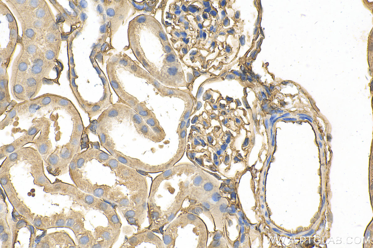 IHC staining of mouse kidney using 11256-1-AP