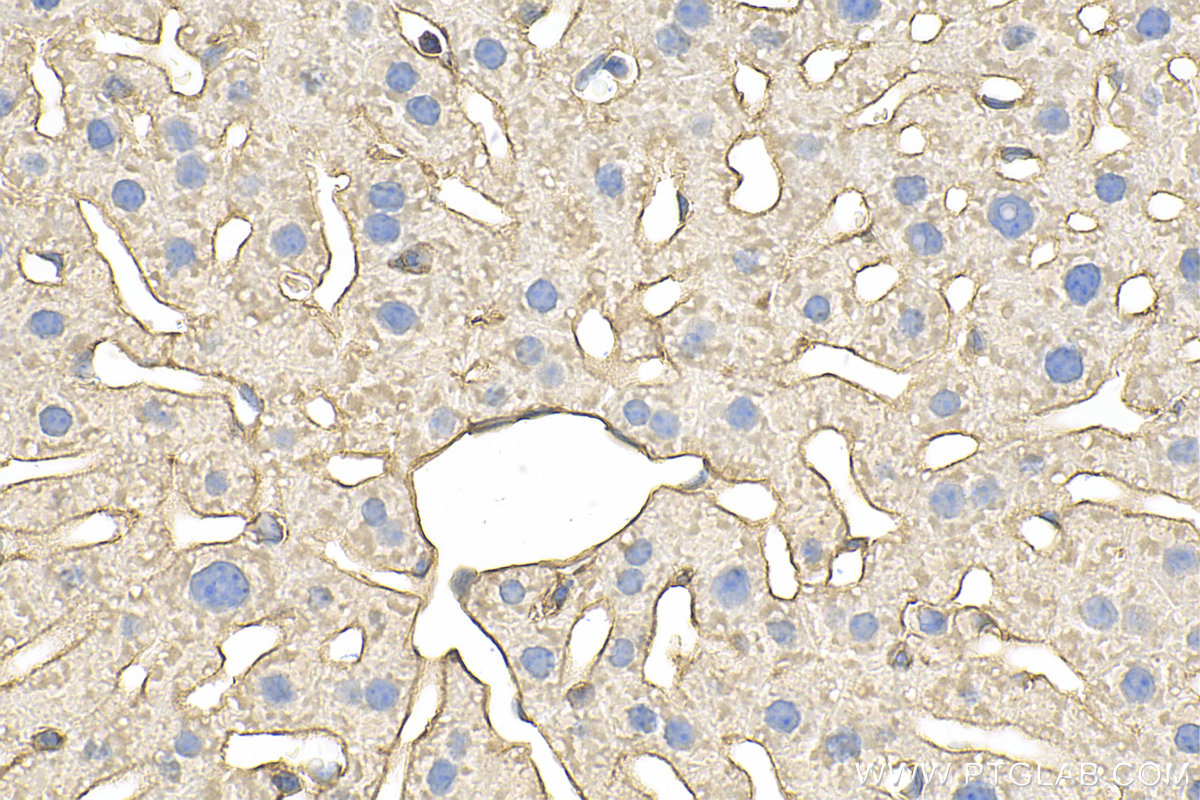 IHC staining of mouse liver using 11256-1-AP