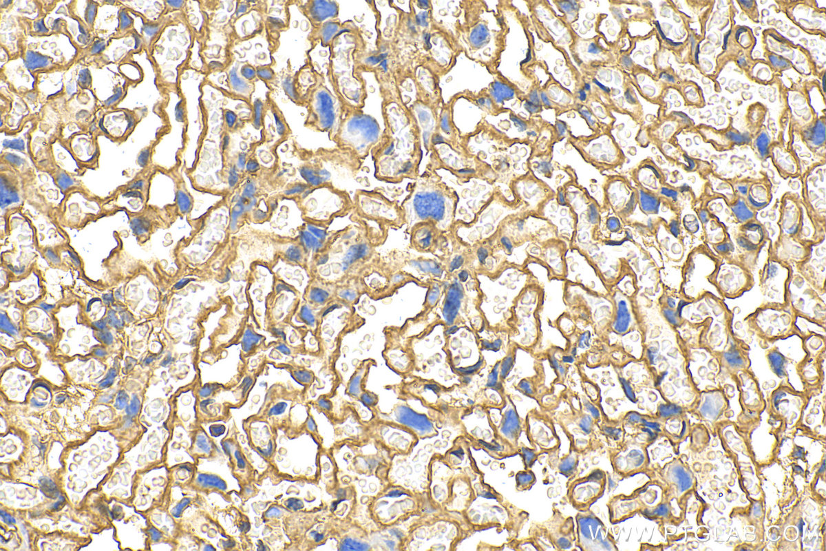 IHC staining of mouse placenta using 11256-1-AP