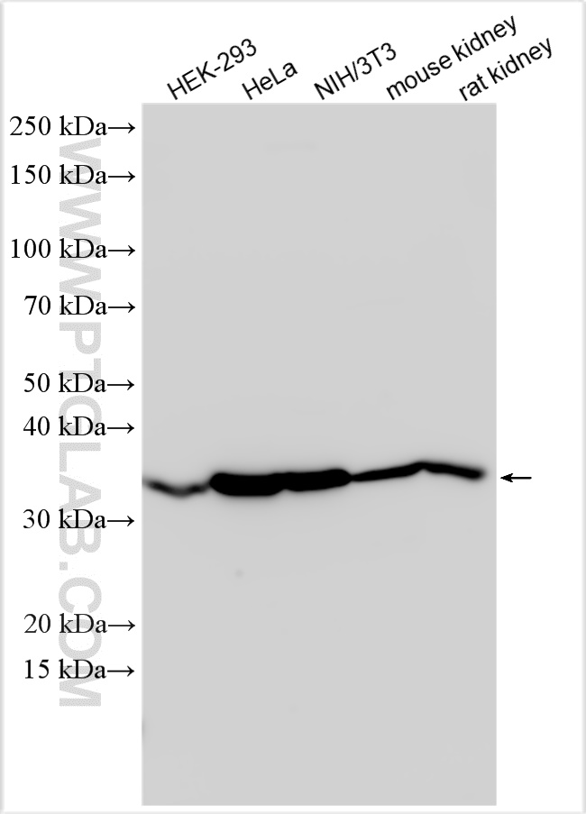 WB analysis using 11256-1-AP