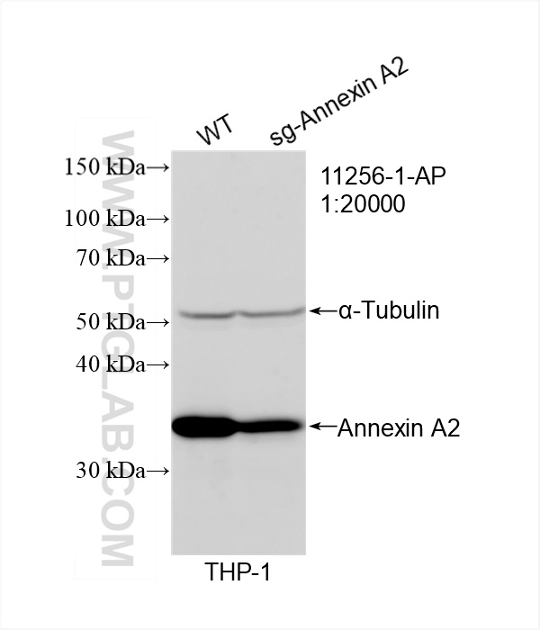 WB analysis of THP-1 using 11256-1-AP