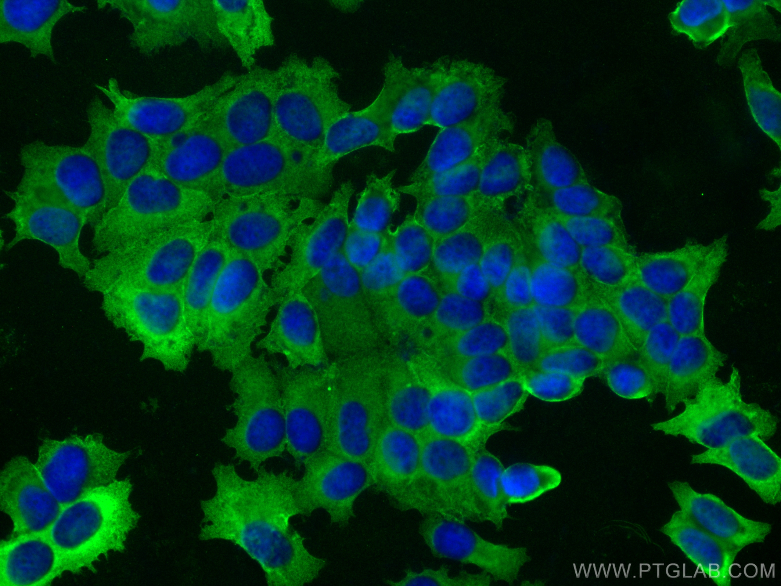 IF Staining of MCF-7 using 60051-1-Ig (same clone as 60051-1-PBS)