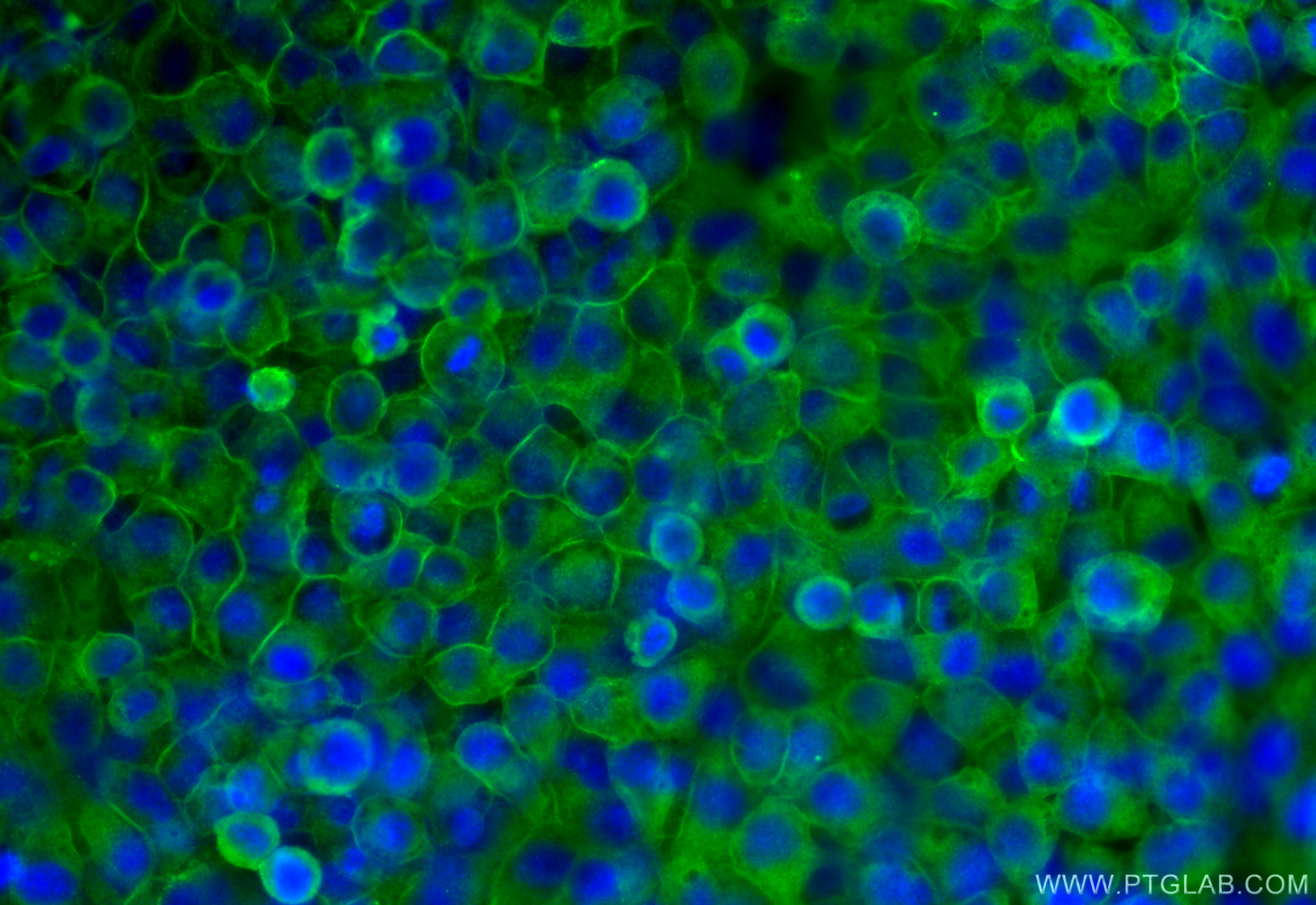 IF Staining of HeLa using 11060-1-AP