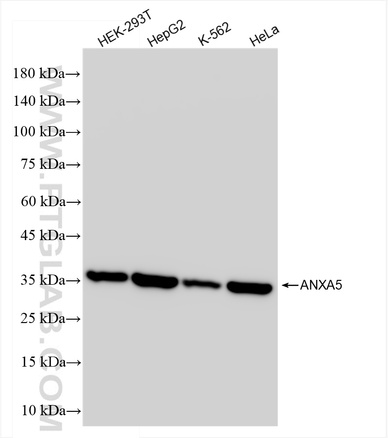 WB analysis using 83929-1-RR