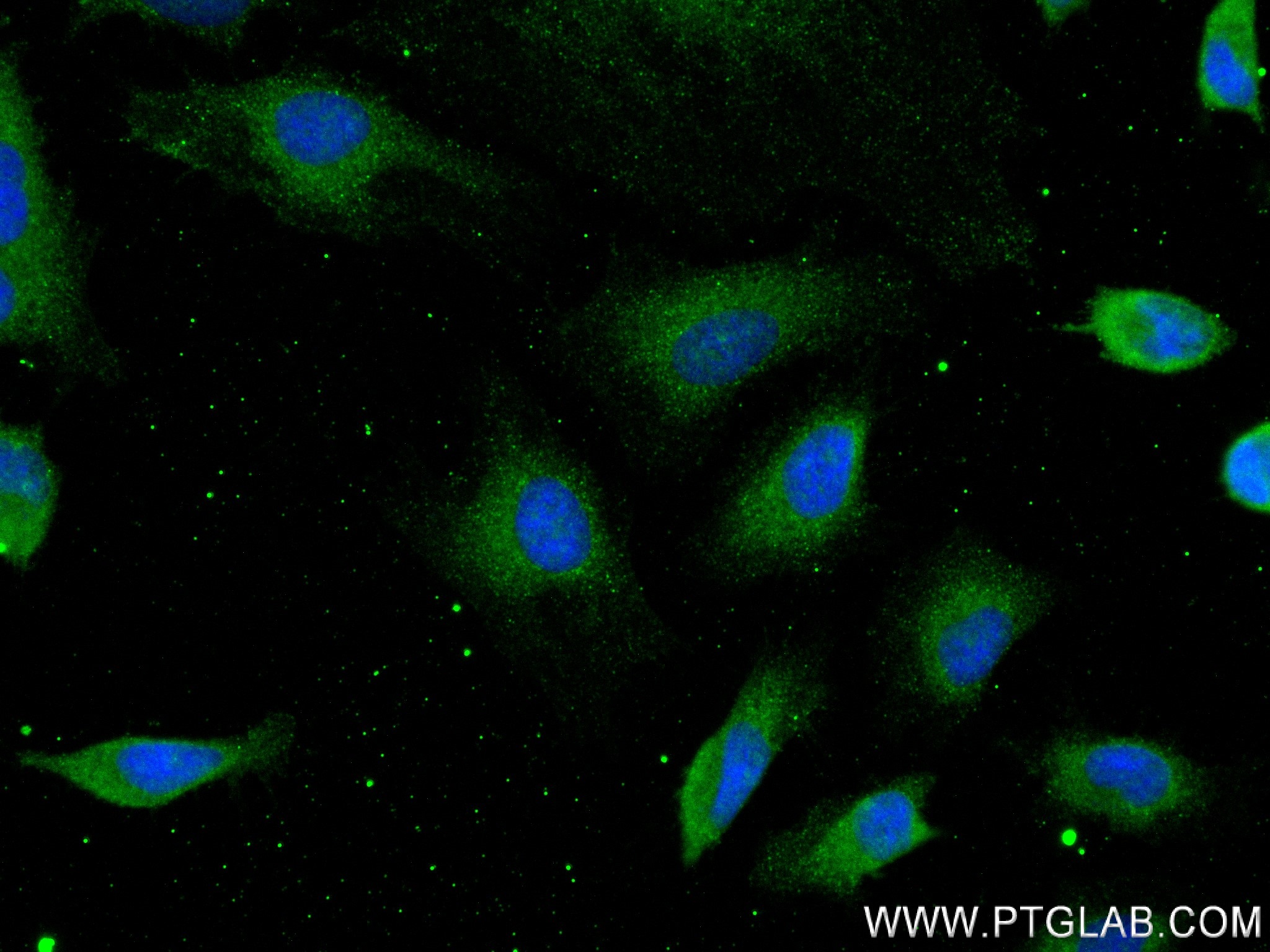 IF Staining of HeLa using 83929-2-RR