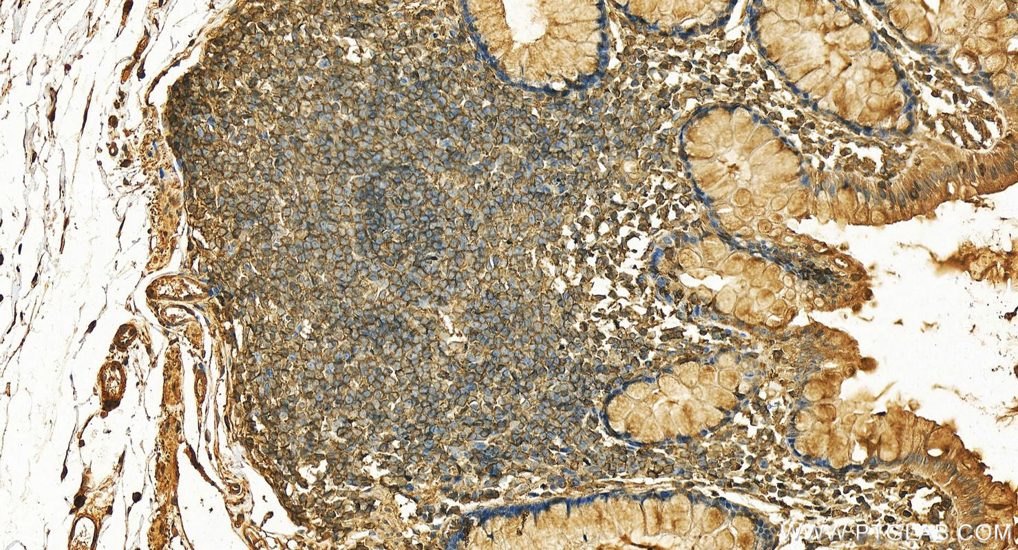 IHC staining of human normal colon using 12542-1-AP