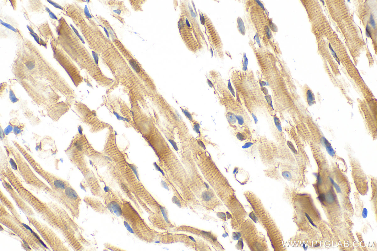 IHC staining of mouse heart using 10154-2-AP