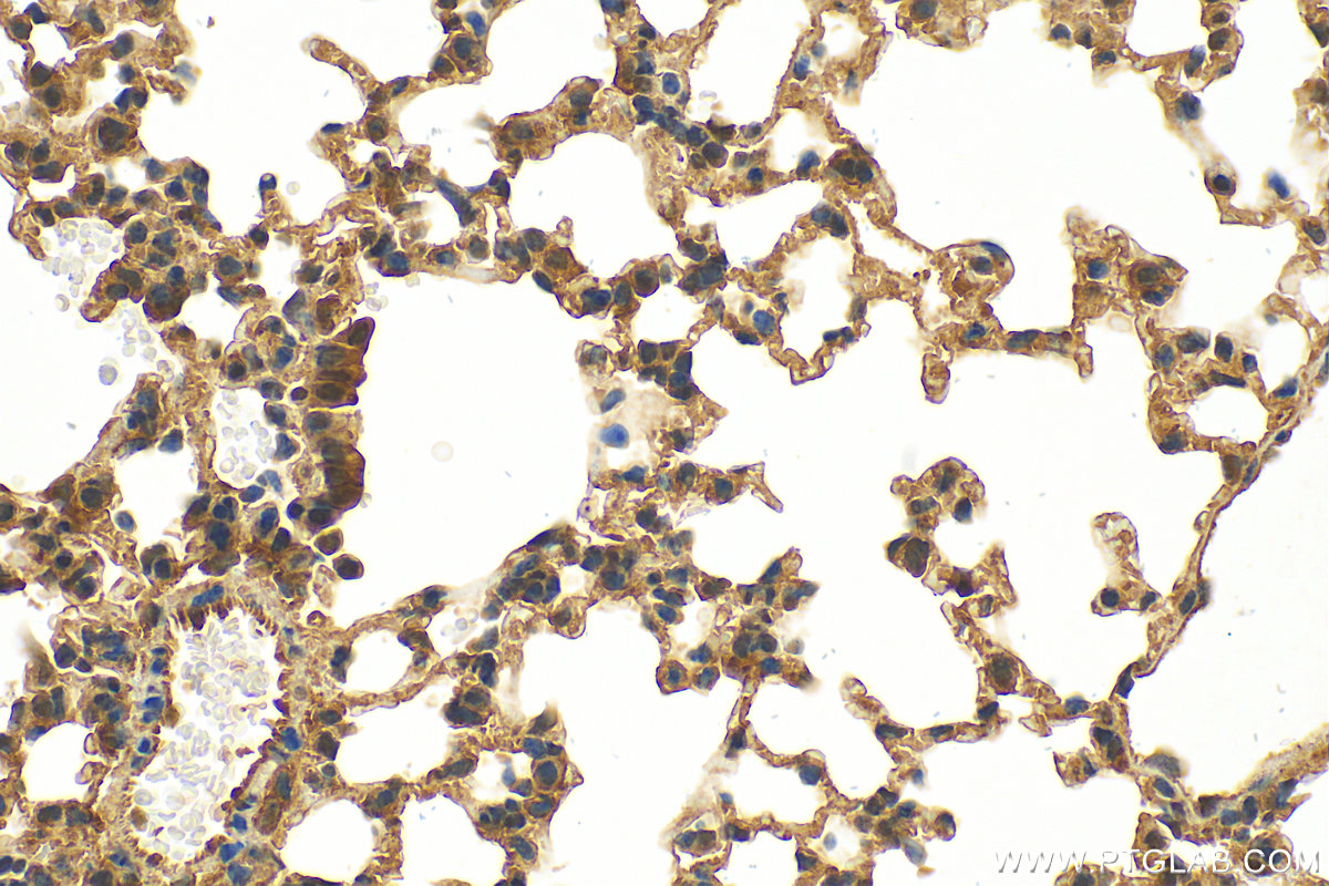 IHC staining of mouse lung using 10154-2-AP