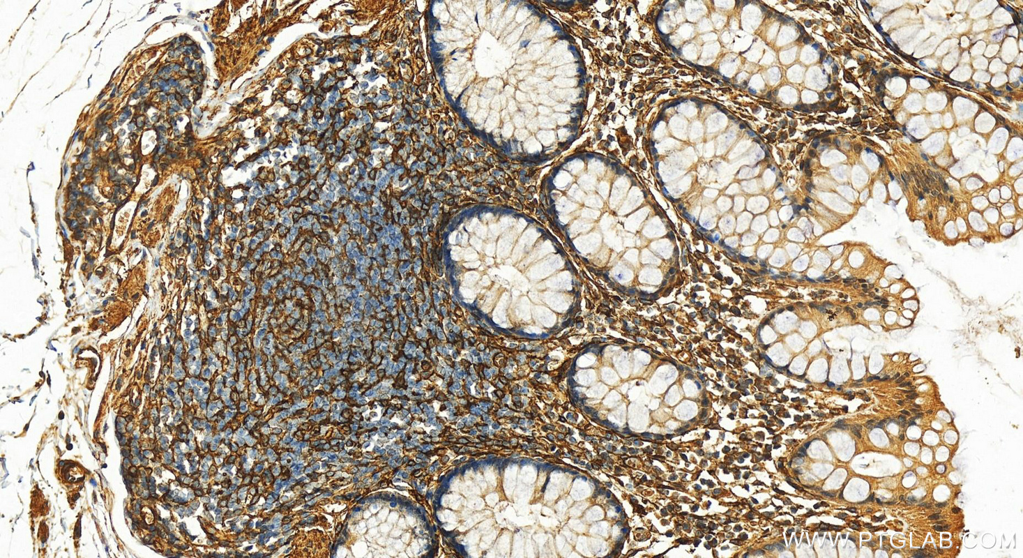 IHC staining of human colon using 14365-1-AP