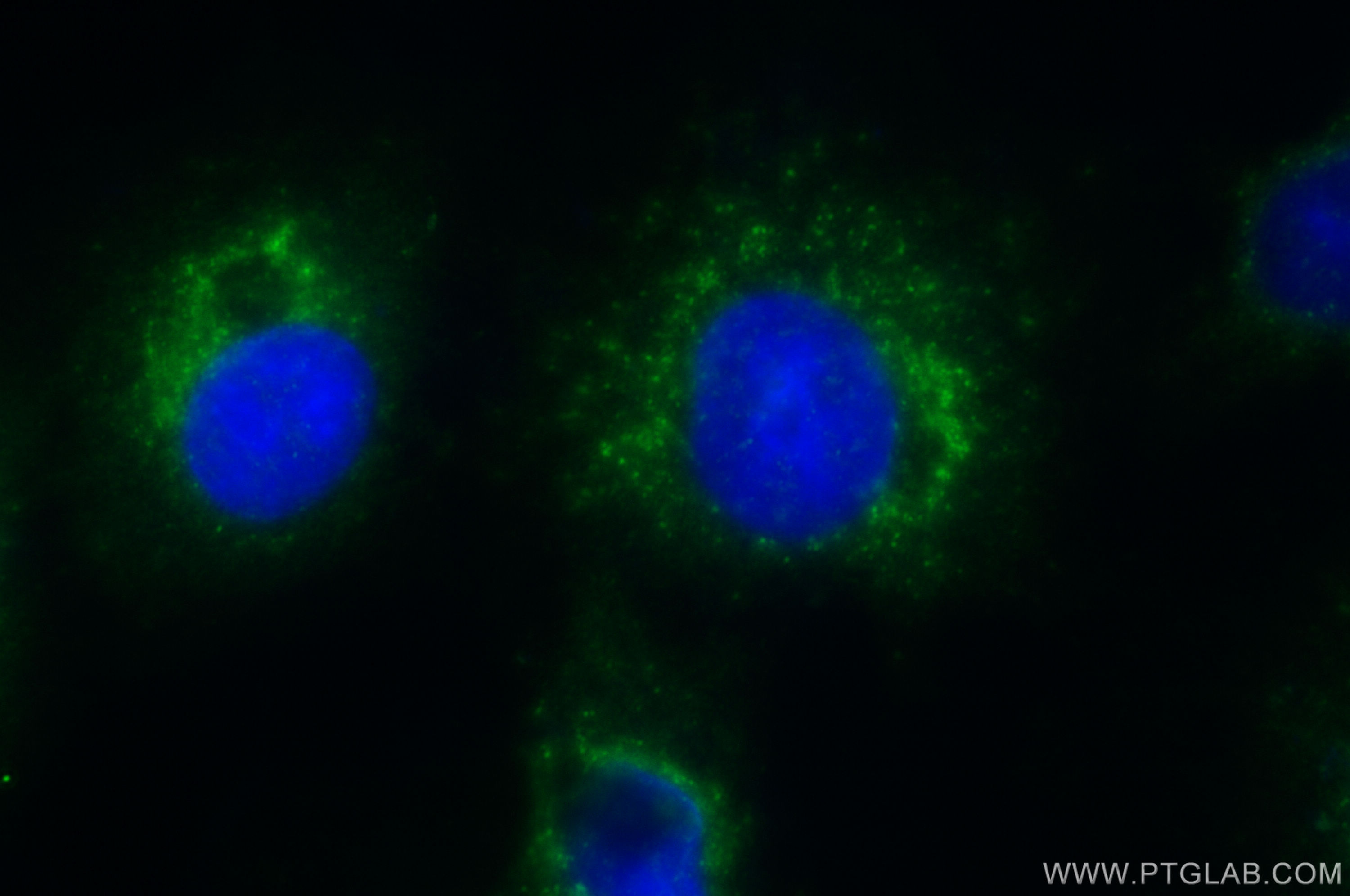 IF Staining of A549 using 10957-1-AP