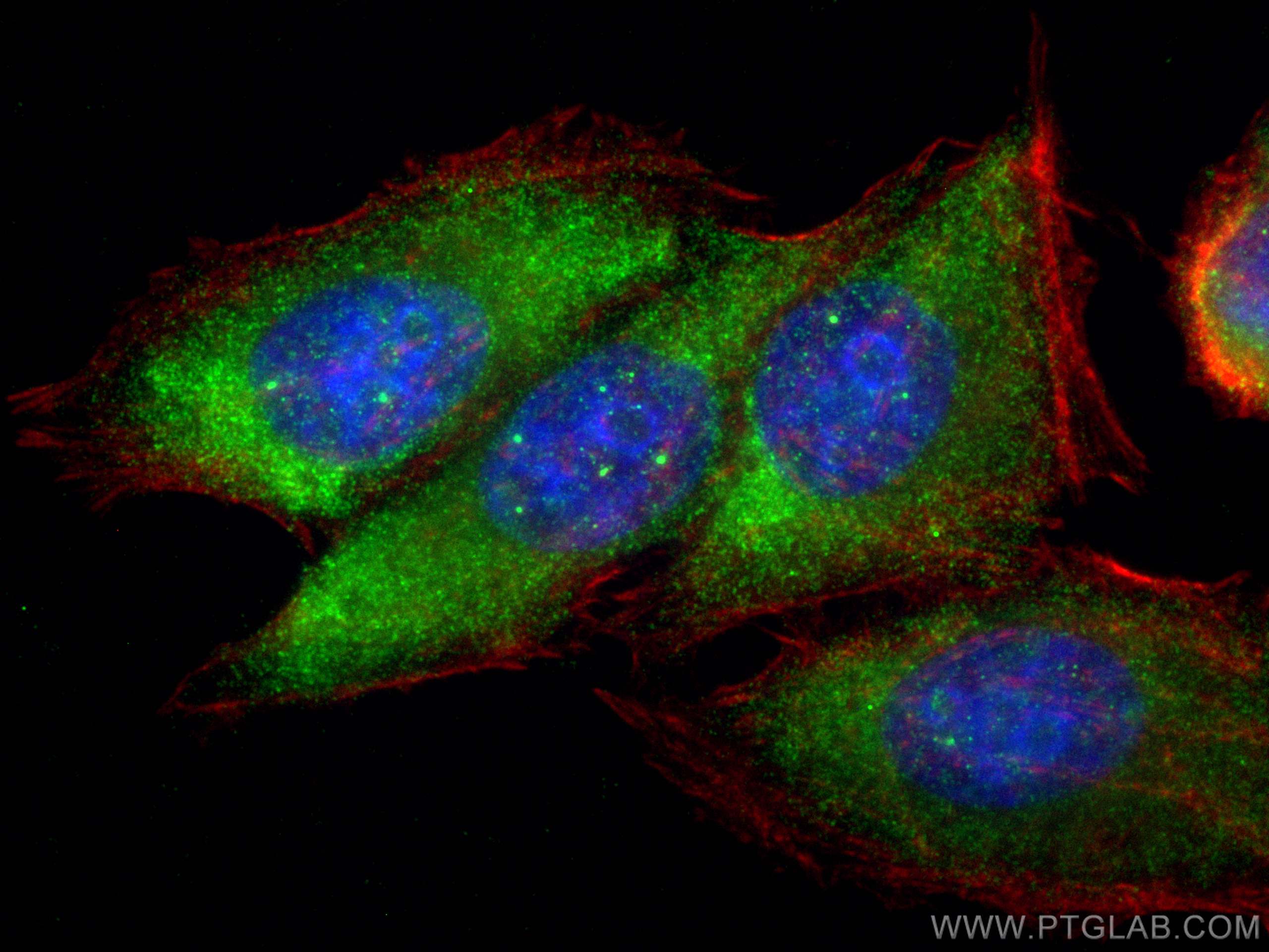 IF Staining of HepG2 using 19495-1-AP